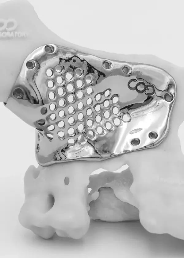 dlyte_sc_024_FacialImplants-600x0-c-default